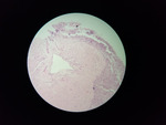 MISSING THUMBNAIL